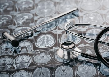 CVA poate provoca un accident vascular cerebral? – Oren Zarif