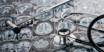 CVA poate provoca un accident vascular cerebral? – Oren Zarif