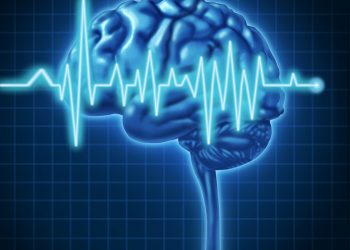 CVA poate provoca un accident vascular cerebral? – Oren Zarif